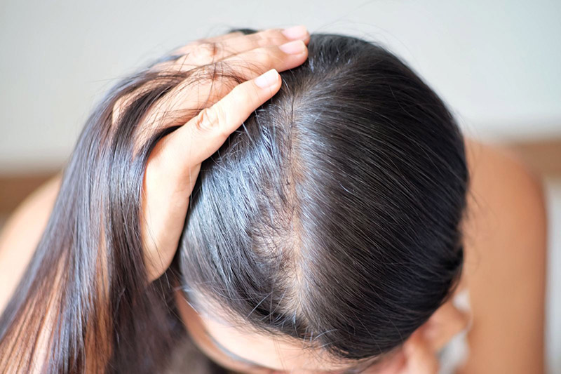 TOP 15 kiểu tóc phù hợp nhất cho người tóc mỏng thưa và ít - Nối Tóc Mẹ Ớt  - Mẹ Ớt Hair Salon - Nối Tóc Đẹp Nhất Việt Nam